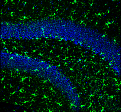 Stain of microglia and cell bodies in the dentate gyrus of the murine brain