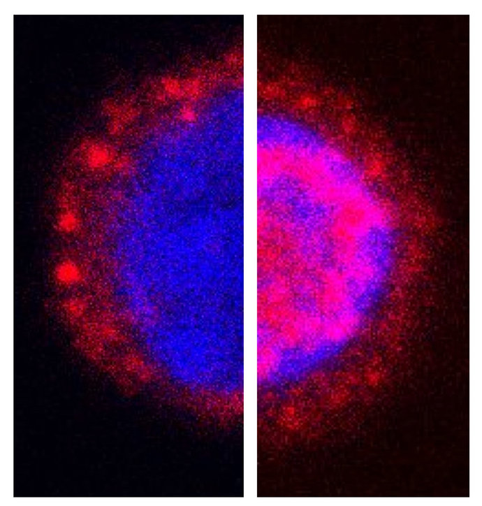 T-lymphocytes before (left) and after (right) the treatment with X-rays. 